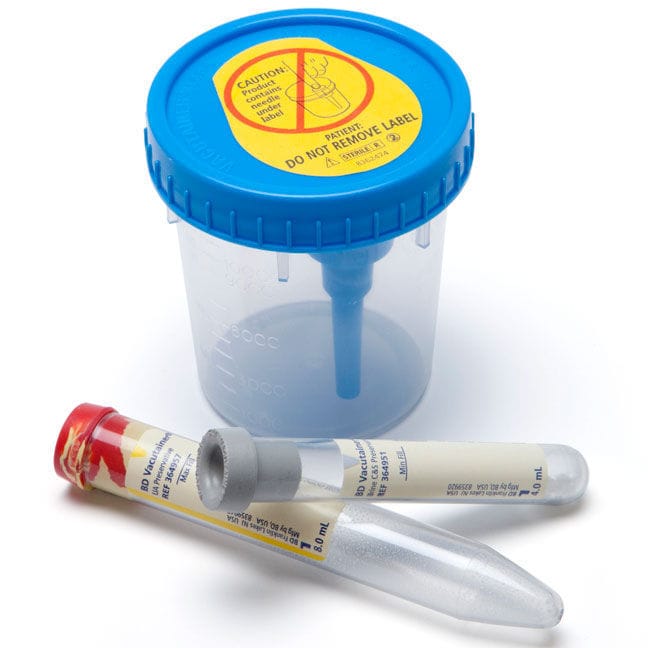 Analisi urine: Provetta o contenitori? - EtruriaNews