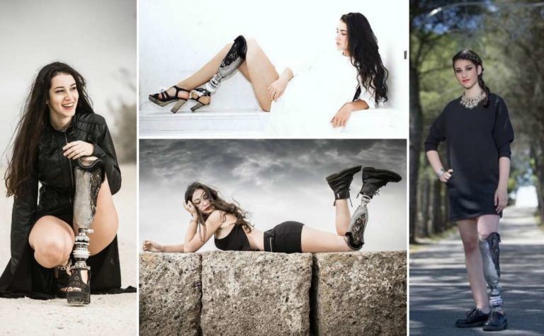 chiara-bordi-miss-con-la-protesi