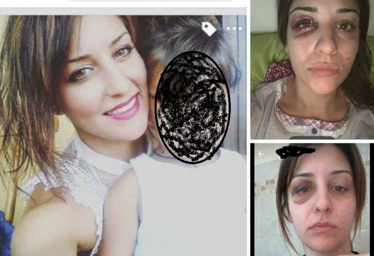 ragazza picchiata a tarquinia apre