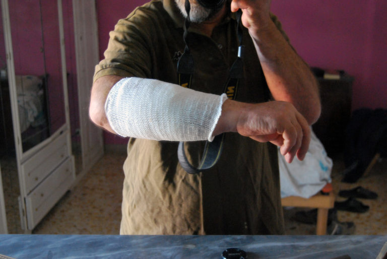 La persona aggredita dai cani