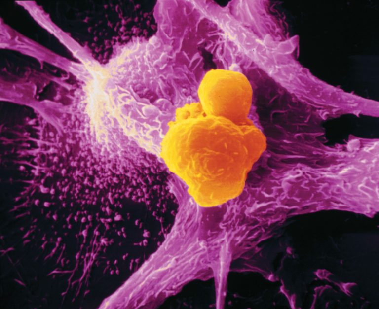 cancer_cell