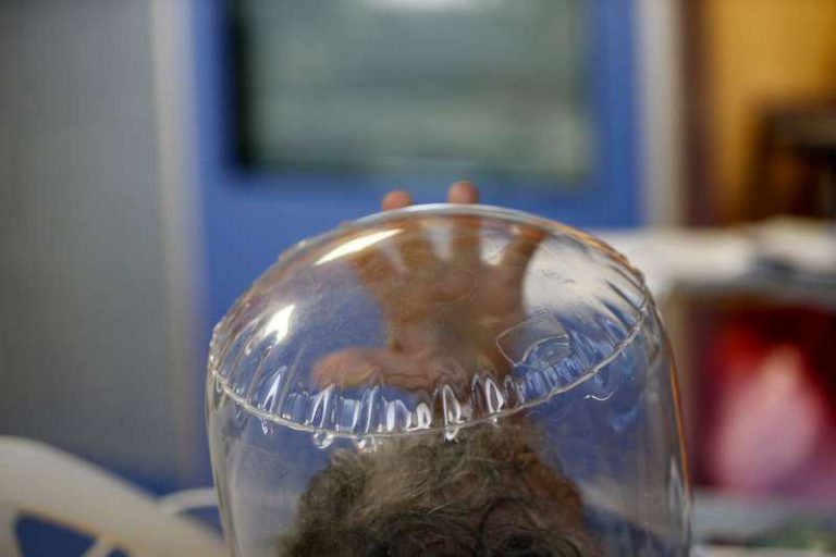 CASCO COVID OSPEDALE