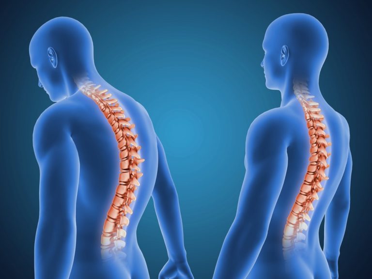 postura-osteopaya