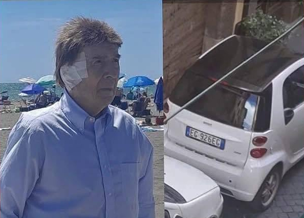 scomparsa profili e smart bianca